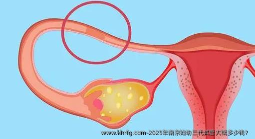 2025年南京妇幼三代试管大概多少钱？