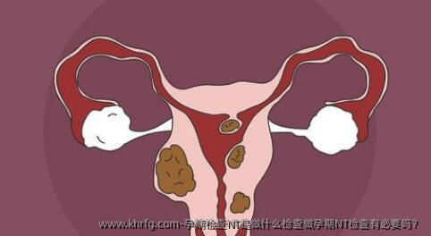 孕期检查NT是做什么检查做孕期NT检查有必要吗？