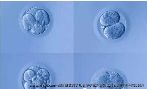 泰国做试管婴儿要多少钱？泰国试管婴儿的卵子冒险记录