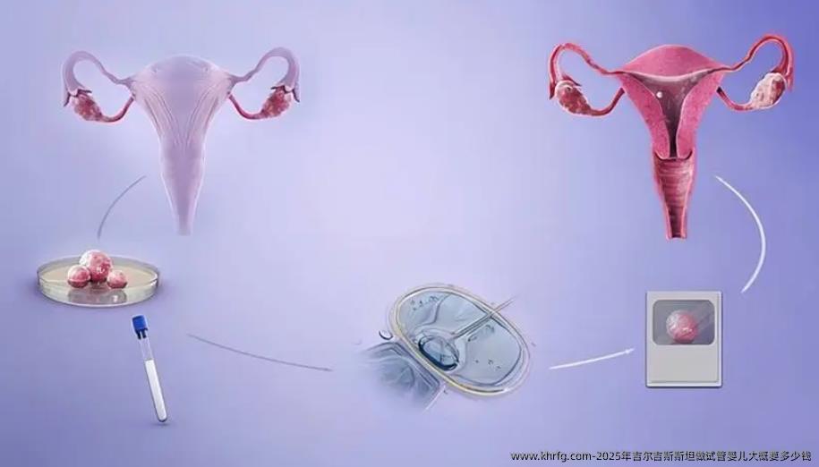 2025年吉尔吉斯斯坦做试管婴儿大概要多少钱