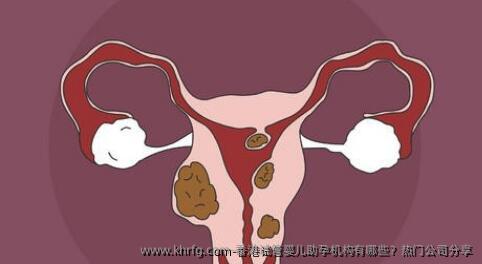 香港试管婴儿助孕机构有哪些？热门公司分享