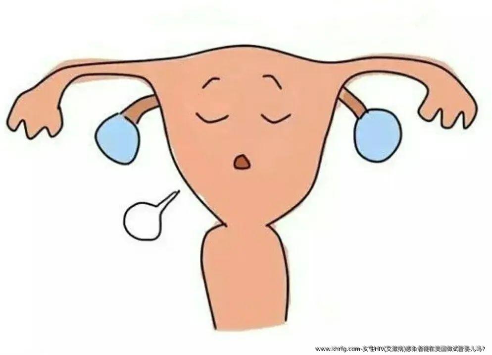 女性HIV(艾滋病)感染者能在美国做试管婴儿吗？