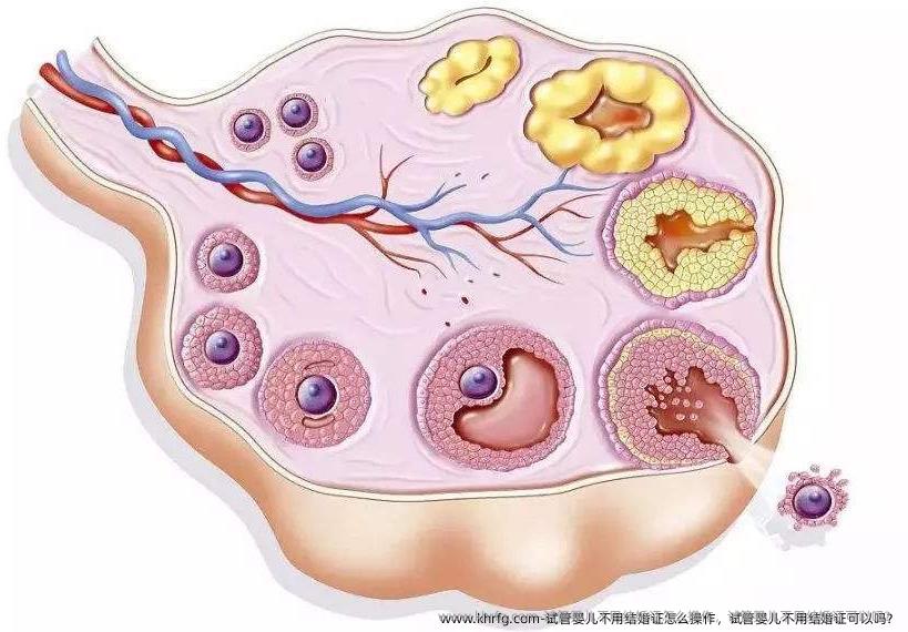 试管婴儿不用结婚证怎么操作，试管婴儿不用结婚证可以吗？