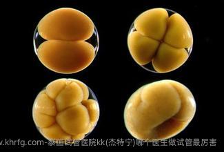 泰国试管医院kk(杰特宁)哪个医生做试管最厉害