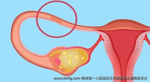 郴州第一人民医院三代试管婴儿费用是多少