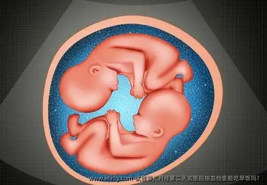 试管婴儿月经第二天去医院抽血检查能吃早饭吗？
