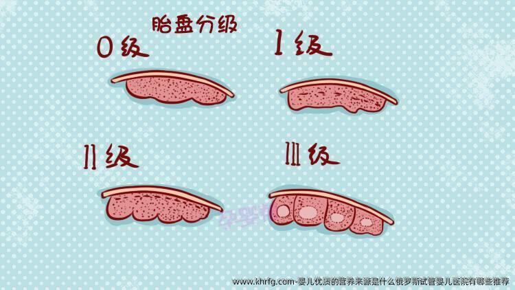 婴儿优质的营养来源是什么俄罗斯试管婴儿医院有哪些推荐