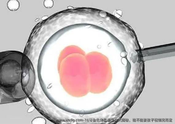 16号染色体是谁决定大揭秘，能不能要孩子视情况而定