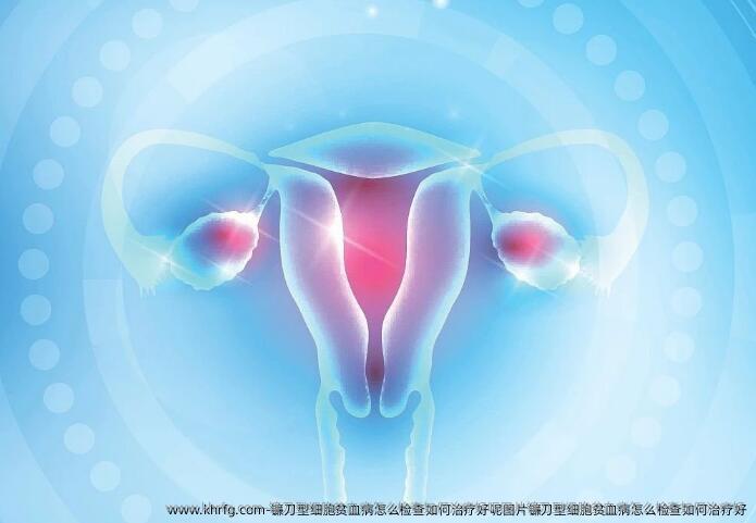 镰刀型细胞贫血病怎么检查如何治疗好呢图片镰刀型细胞贫血病怎么检查如何治疗好