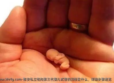 雅安私立机构第三代婴儿试管的流程是什么，详细步骤速览