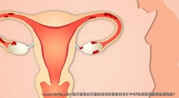 短方案和长方案的成功率具体有多少?PGT检测能筛查哪些遗传病？