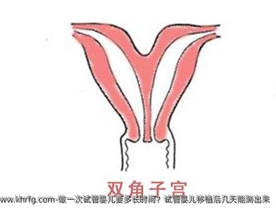 做一次试管婴儿要多长时间？试管婴儿移植后几天能测出来
