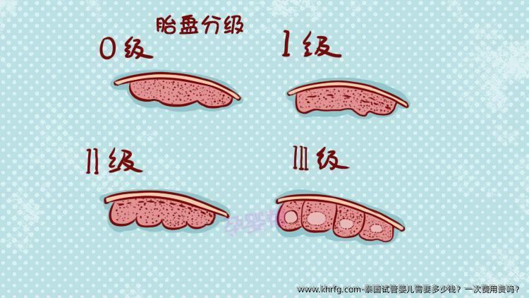 泰国试管婴儿需要多少钱？一次费用贵吗？