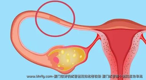 厦门较好的试管医院排名榜较新 厦门试管哪个医院成功率高