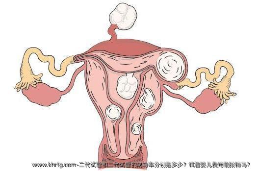 二代试管和三代试管的成功率分别是多少？试管婴儿费用能报销吗？