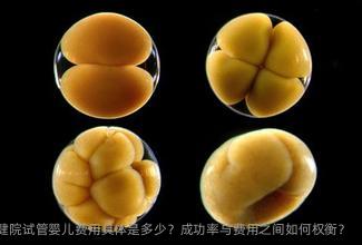 开封市妇幼保健院试管婴儿费用具体是多少？成功率与费用之间如何权衡？