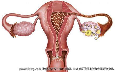 想做试管婴儿但fsh值高-应该如何降低fsh值提高卵巢功能