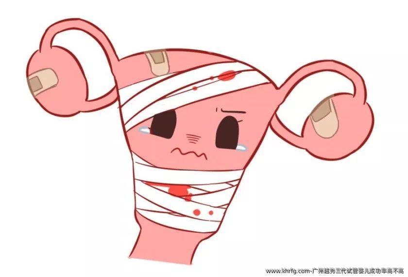 广州越秀三代试管婴儿成功率高不高？做试管婴儿怎么样