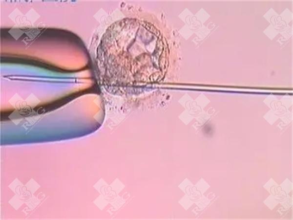 2025年在温州市做试管婴儿费用多少？成功率如何？