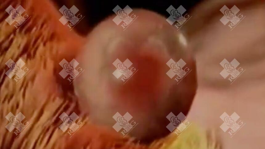 十堰市试管婴儿技术好的医院有哪些？十堰市试管婴儿医院排行