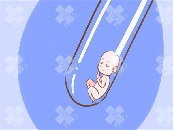 双侧输卵管切除试管还会宫外孕吗？胚胎移植后游离范围参考