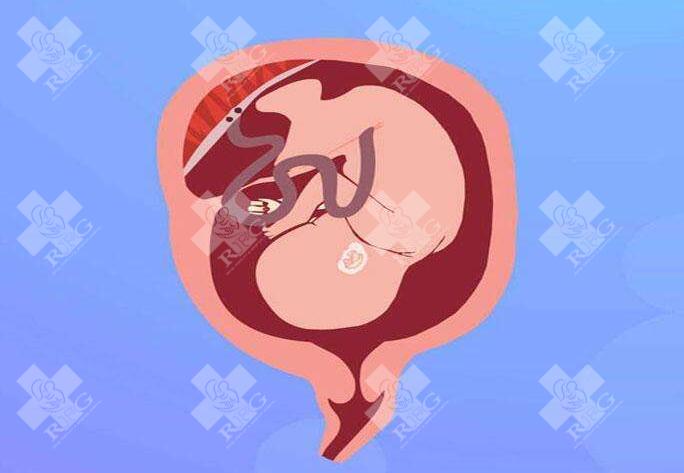 汕头有做试管婴儿的医院都是哪些？汕头试管婴儿费用大约多少？